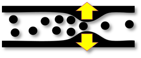 Horizontal bottleneck diagram with yellow arrows indicating relieving/widening the bottlneck.